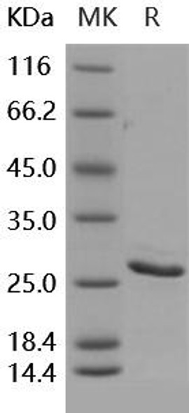 Human BCL2/Bcl-2 Recombinant Protein (His Tag) (Active) (RPES0599)