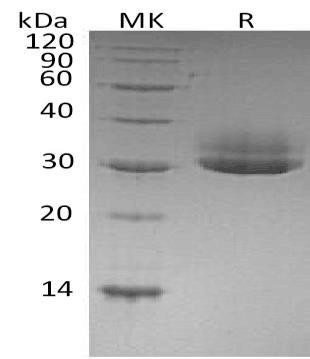 Human CTRL Recombinant Protein (RPES0604)
