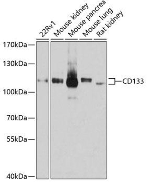 Anti-CD133 Antibody (CAB12711)[KO Validated]