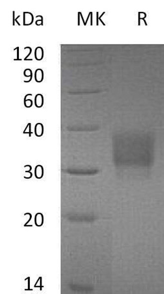 Mouse CD32b/FCGR2B Recombinant Protein (RPES0629)