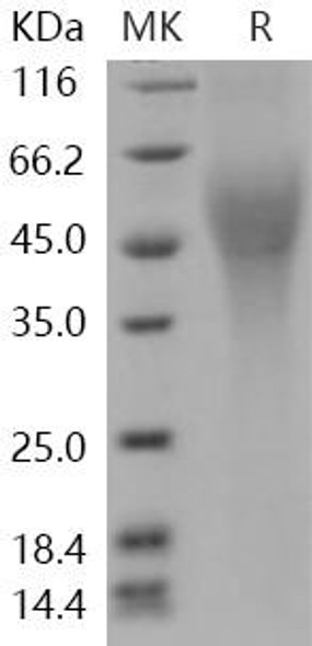 Human CD200R1L/CD200R2/CD200RLa Recombinant Protein (His Tag) (RPES0637)