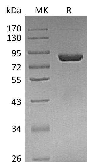 Human THOP1 Recombinant Protein (RPES0647)