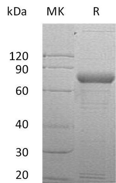 Human SIRP gamma/CD172g Recombinant Protein (His Tag) (Active) (RPES0679)