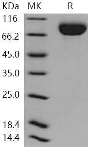Human CD111/Nectin Recombinant Protein (Fc Tag) (Active) (RPES0727)