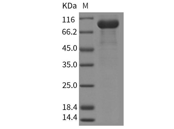 Mouse Osteoprotegerin/TNFRSF11B Recombinant Protein (Fc Tag) (RPES0755)