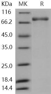 Human PDE1B Recombinant Protein (His & GST Tag) (RPES0840)
