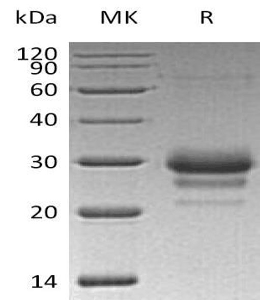 Human TFPI2 Recombinant Protein (RPES0844)