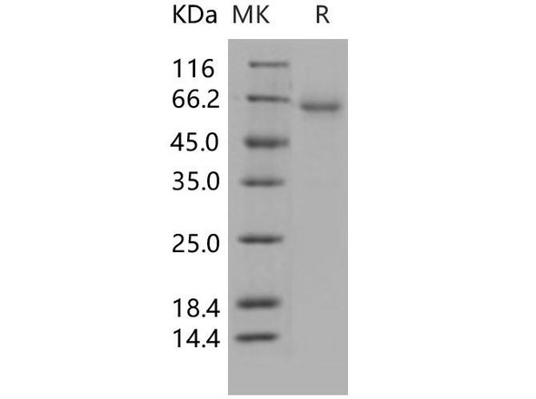 Human CXADR/CAR Recombinant Protein (His & Fc Tag) (Active) (RPES0891)