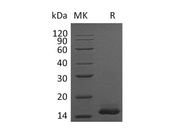 Mouse PDGF-BB Recombinant Protein (RPES0906)