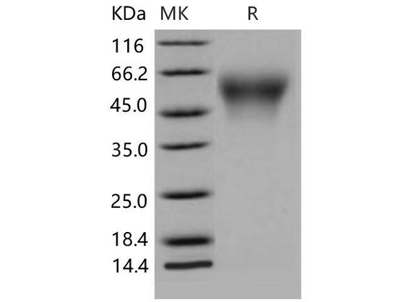 Mouse CD34 Recombinant Protein (His Tag) (Active) (RPES0948)
