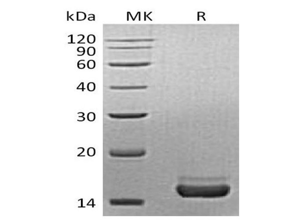 Mouse PLA2G1B/PLA2 Recombinant Protein (RPES0960)