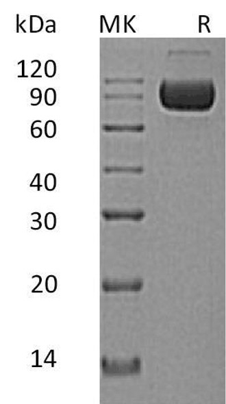 Human ILRAcP/IL1R3 Recombinant Protein (RPES0989)
