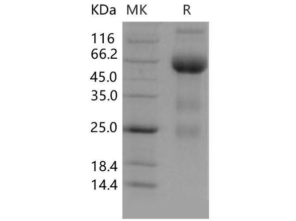 Mouse VEGFR3/FLT4 Recombinant Protein (RPES1002)