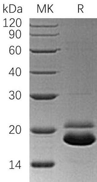 Human TRAIL R2/TNFRSF10B Recombinant Protein (RPES1008) Human TRAIL R2/TNFRSF10B Recombinant Protein (RPES1008)
