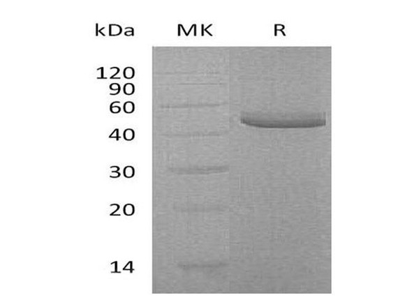 Human TRAIL R2/TNFRSF10B Recombinant Protein (RPES1024) Human TRAIL R2/TNFRSF10B Recombinant Protein (RPES1024)