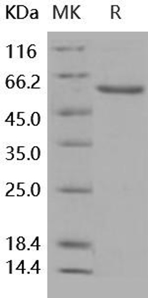 Human NBL1/DAND1 Recombinant Protein (Fc Tag) (Active) (RPES1051)