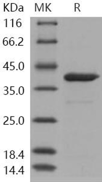 Human Arginase/ARG1 Recombinant Protein (RPES1087)