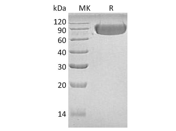 Human LAG3/CD223 Recombinant Protein (RPES1102)
