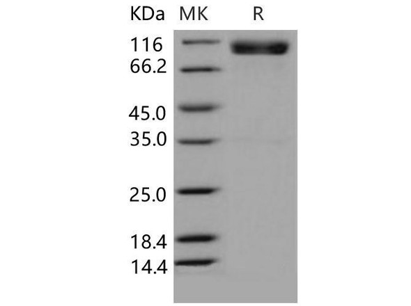 Mouse EphA4/HEK8 Recombinant Protein (RPES1110)