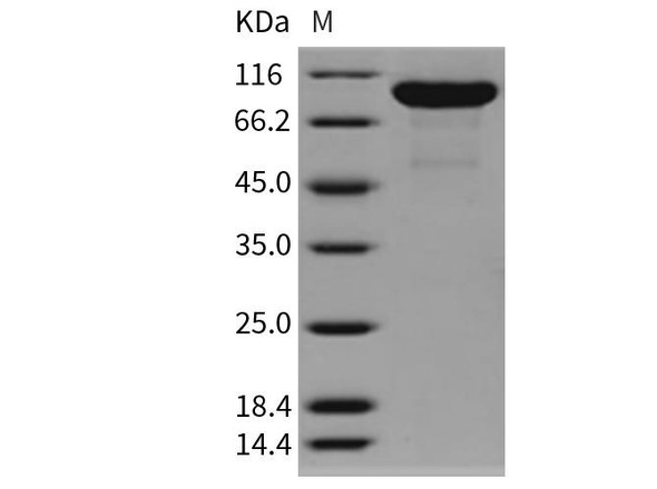 Rat MMP-9 Recombinant Protein (RPES1185)