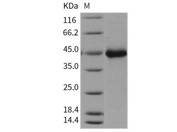 Mouse Wnt Inhibitory Factor 1/WIF1 Recombinant Protein (His Tag) (RPES1192)