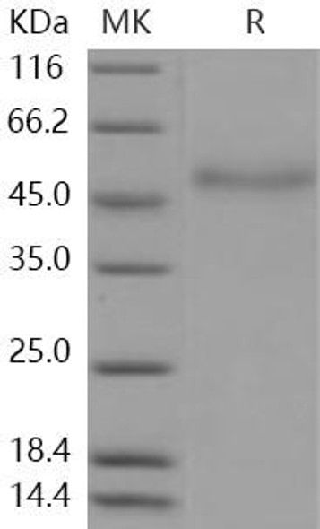 Human Coagulation Factor VII/F7 Recombinant Protein (His Tag) (RPES1254)