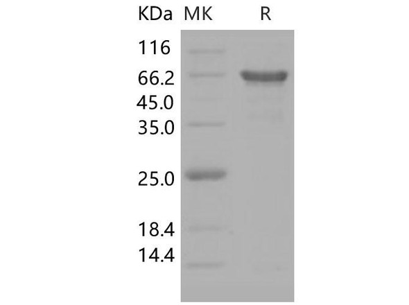 Human APP/Protease nexin-II Recombinant Protein (RPES1288)