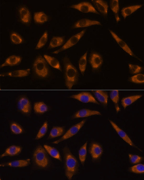 Anti-GNAQ Antibody (CAB14736)