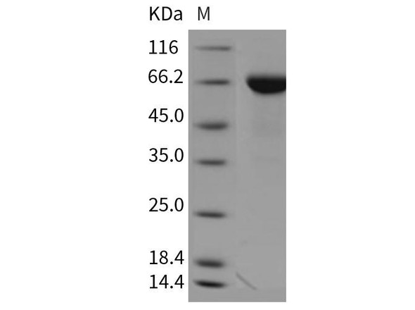 Mouse TROP2/TACSTD2 Recombinant Protein (RPES1333)