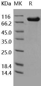 Human ILR9/IL1RAPL2 Recombinant Protein (RPES1344)