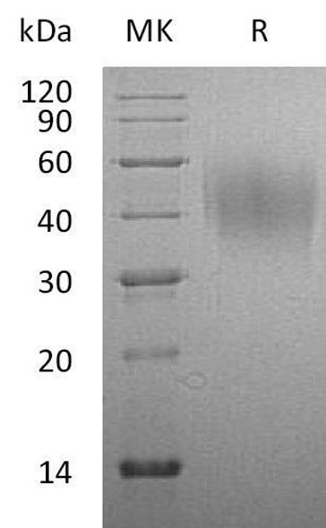 Rat CD86/B7-2 Recombinant Protein (His Tag) (Active) (RPES1402)