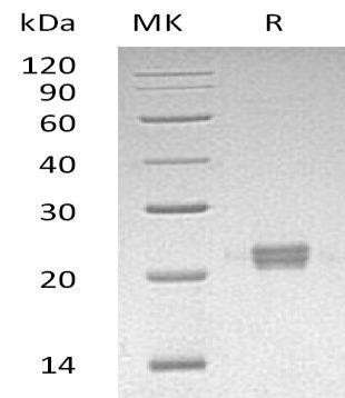 Human ITPase/ITPA Recombinant Protein (RPES1445)