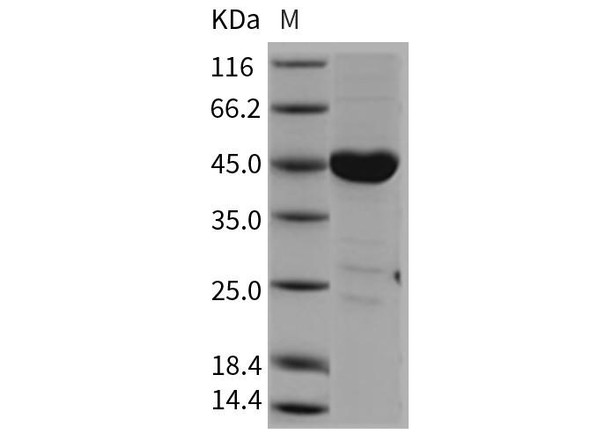 Mouse CSK/C-Src kinase Recombinant Protein (RPES1448)