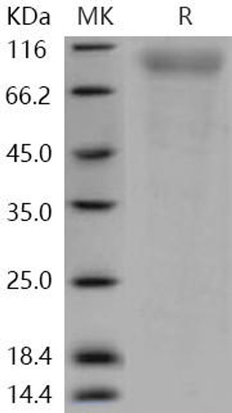 Human CD180/RP105/LY64 Recombinant Protein (RPES1463)
