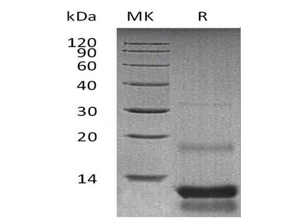 Mouse IGF1 (Long-R3-IGF1) Recombinant Protein (His Tag) (Active) (RPES1494)