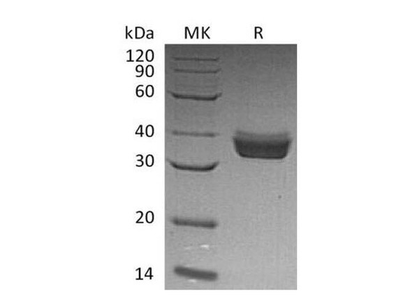 Human ERP27 Recombinant Protein (RPES1531)