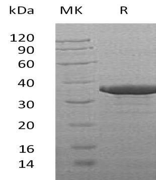 Human SULT2B1 Recombinant Protein (aa 2-365, His Tag) (RPES1594)