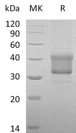 Human TNFRSF1B/CD120b Recombinant Protein (RPES1604)