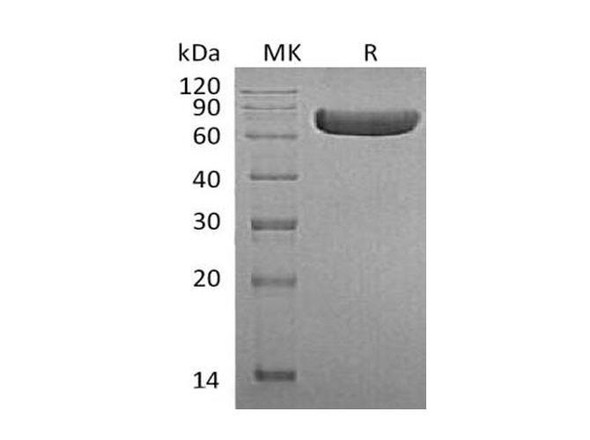 Human TNFRSF1B/CD120b Recombinant Protein (RPES1622)