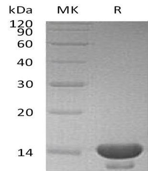 Cystatin C/CST3 Recombinant Protein (E.coli) (RPES1681)
