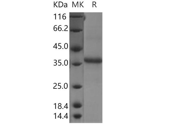 Human CLDN11/Claudin1 Recombinant Protein (Fc Tag) (RPES1694)