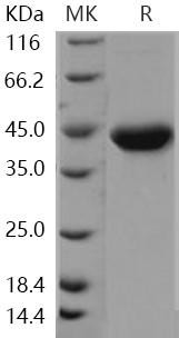 Human Galanin/GAL Recombinant Protein (Fc Tag) (RPES1695)