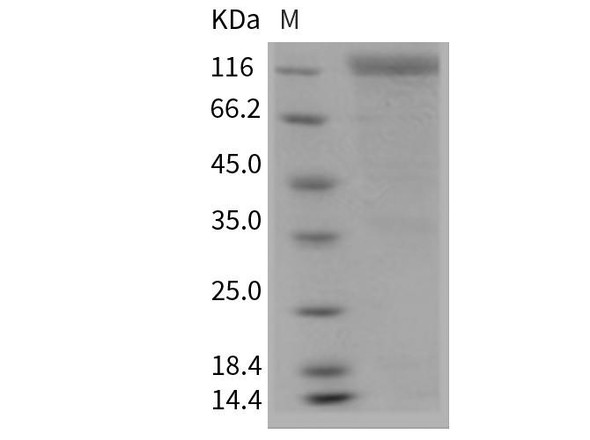 Mouse HER2/ErbB2 Recombinant Protein (Fc Tag) (RPES1717)