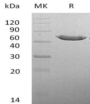 Mouse CPA2 Recombinant Protein (His Tag) (Active) (RPES1725)