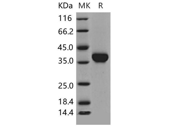 Mouse Carbonic Anhydrase X/CA10 Recombinant Protein (His Tag) (Active) (RPES1744)