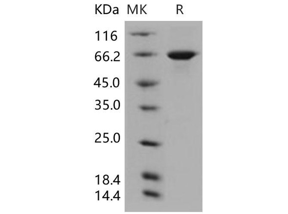 Human USH1C/Harmonin Recombinant Protein (His Tag) (RPES1774)