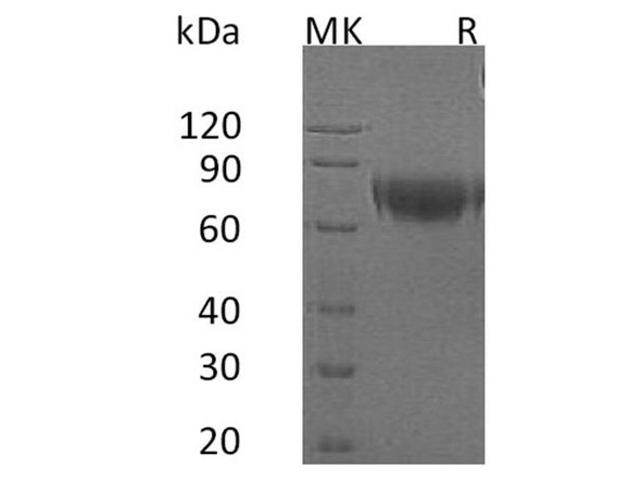 Human IFNAR2 Recombinant Protein (RPES1802)