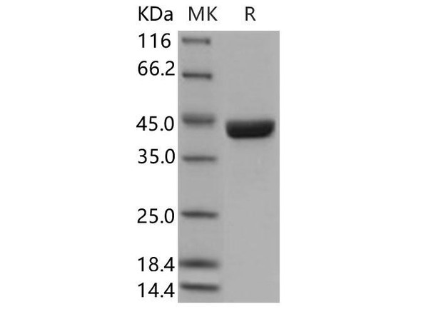 Human SERPINB9/PI-9 Recombinant Protein (Baculovirus, His Tag) (RPES1814)