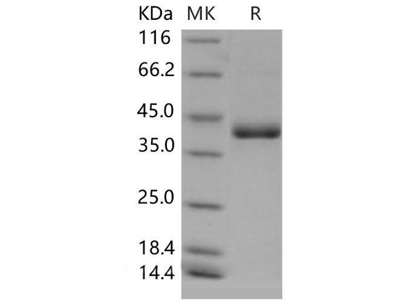 Mouse CD59a/MAC-IP Recombinant Protein (Fc Tag) (RPES1843)