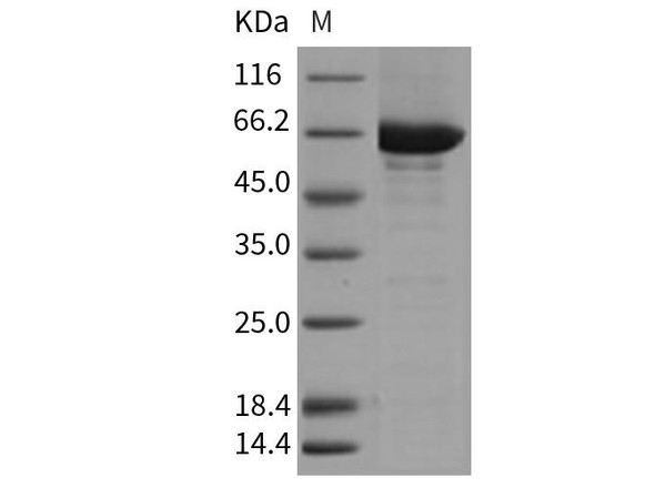 Mouse CSK/C-Src kinase Recombinant Protein (His & GST Tag) (Active) (RPES1855)